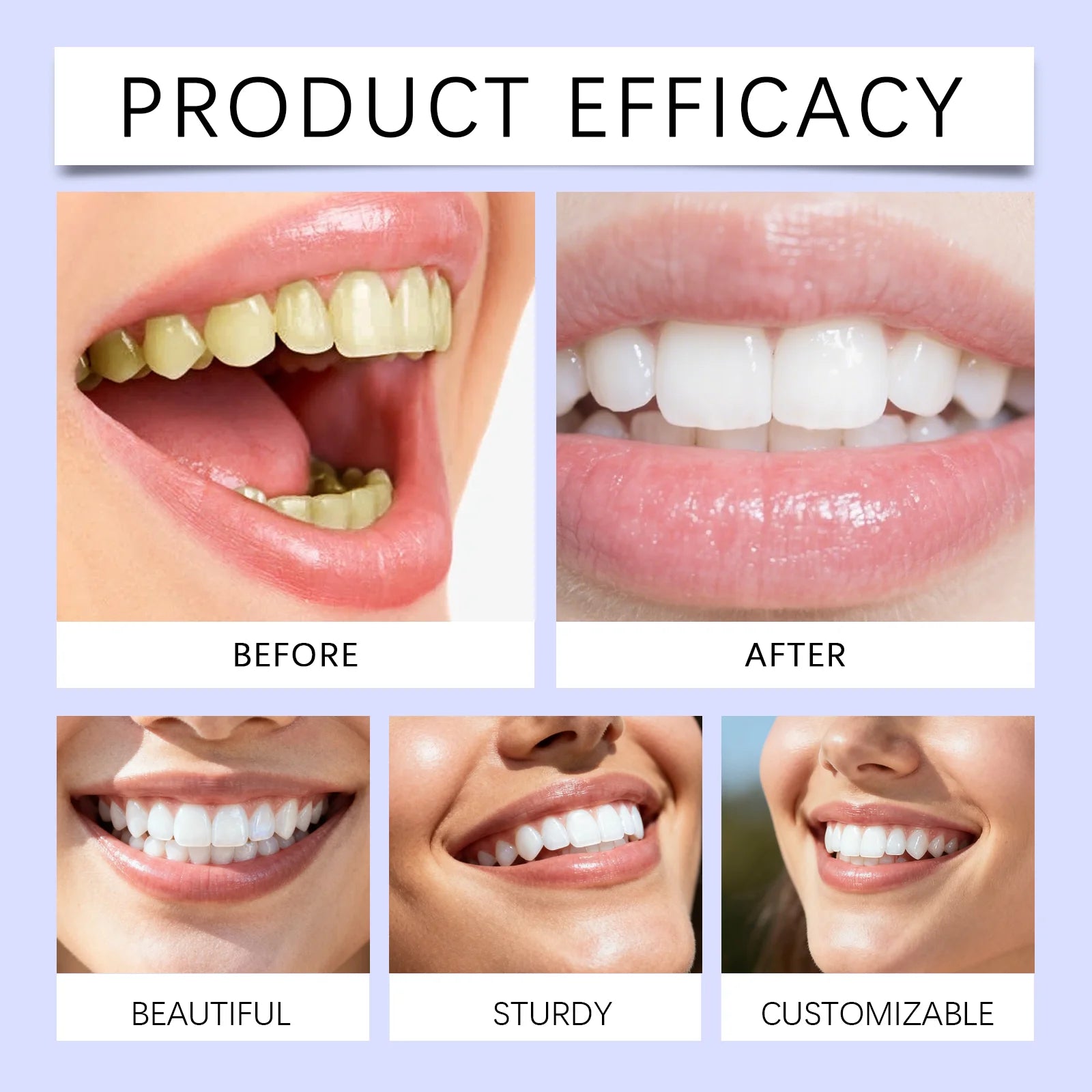 Purple Teeth Whitening Strips - 14 Day Supply